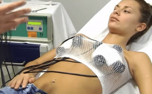contractura capsular aumento de mama