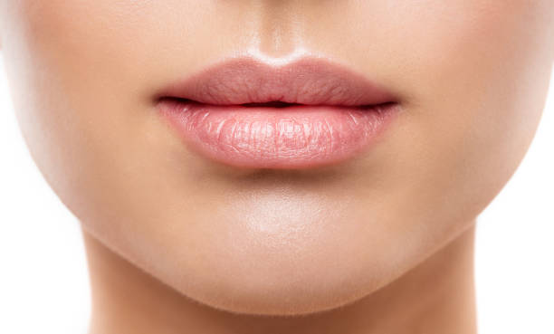 Relleno labios ácido hialurónico