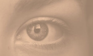 blefaroplastia