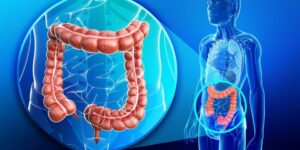 contra el cáncer de colon