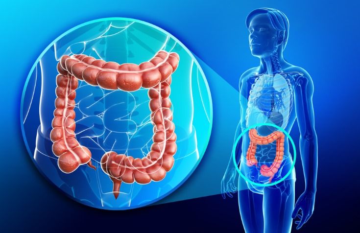 contra el cáncer de colon