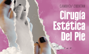 cirugia estetica pie