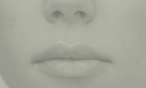 rinoplastia