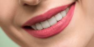 sonrisa gingival tratamiento