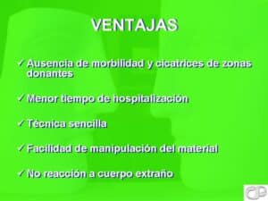 Ventajas