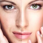 tratamientos antiaging