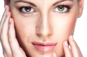 tratamientos antiaging