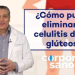 eliminar la celulitis