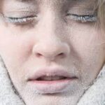 hidrogeneracion facial invierno