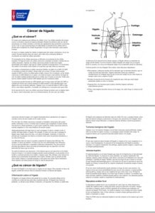 Dr. Josep Mª Llovet articulo