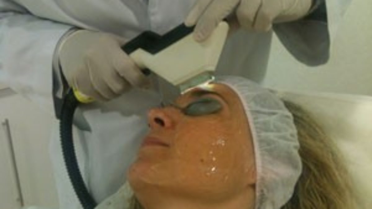 Întrebări frecvente despre Rejuvenare facială fără operație