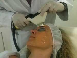 IPL rejuvenecimiento facial