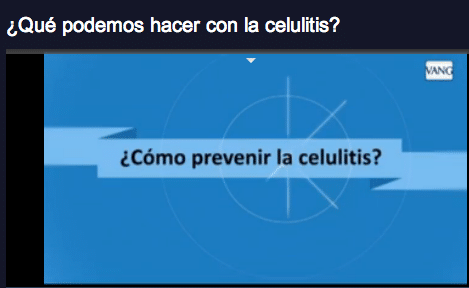 prevenir la celulitis