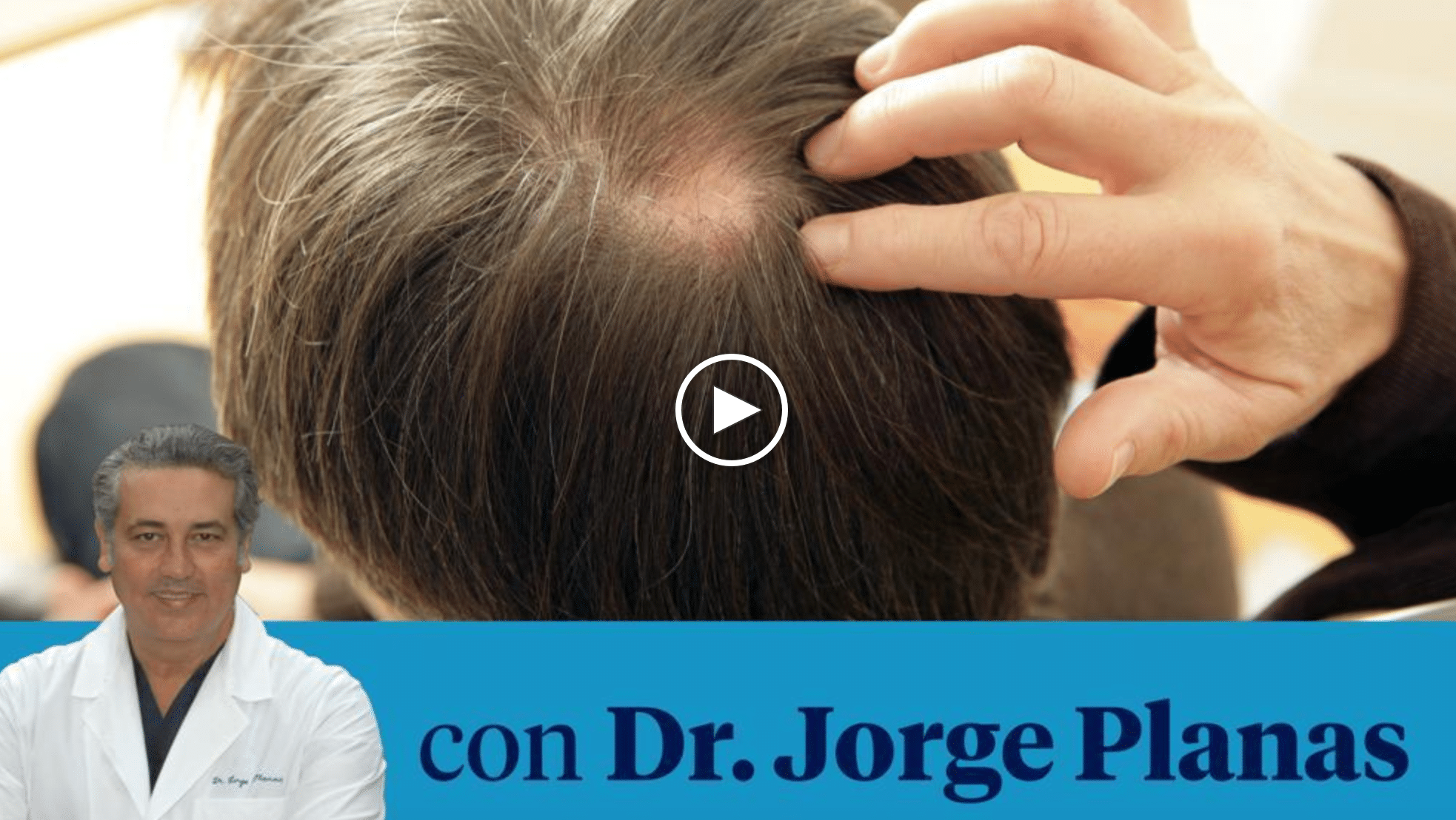 Cómo frenar la caída del cabello Dr. Planas Blog