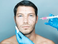 Botox en hombres