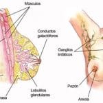 tratamiento preventivo del linfedema