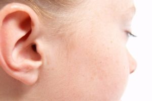 Corrección orejas de soplillo