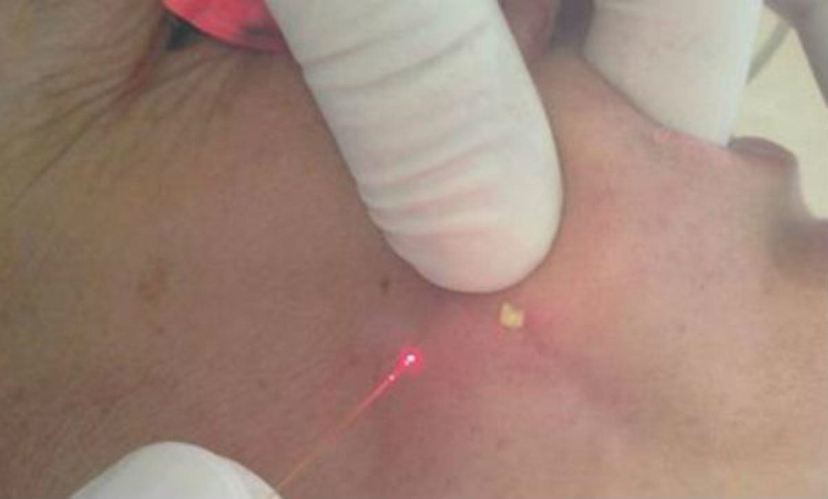 clinica de laser cerca de mi
