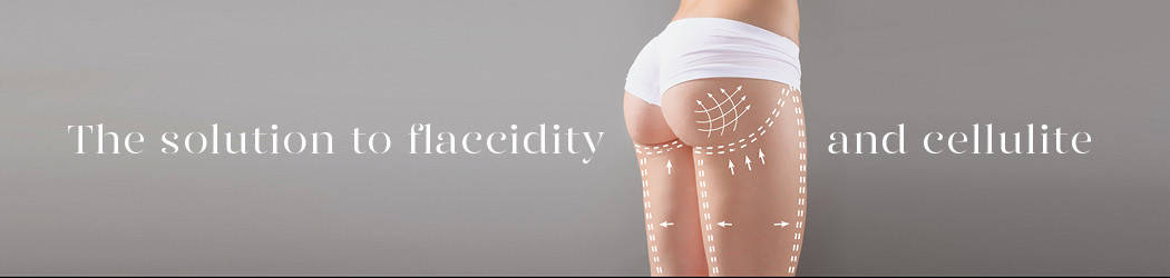 Body laxity. Thermage