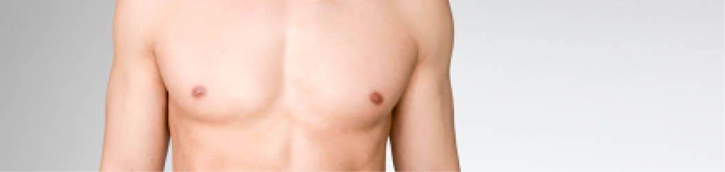 Gynecomastia