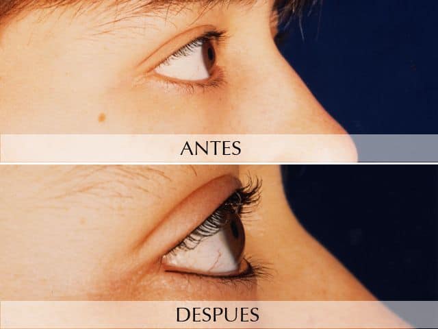 Antes y Después Micropigmentation