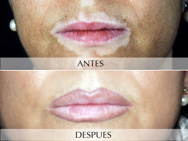 Antes y Después Micropigmentation