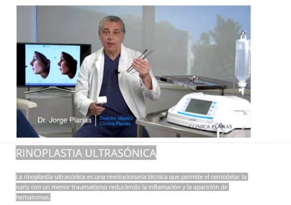 Rinoplastia Ultrasónica