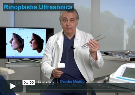 Rinoplastia Ultrasónica (11-07-2018)