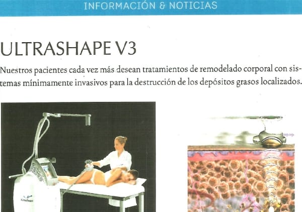 Ultrashape V3