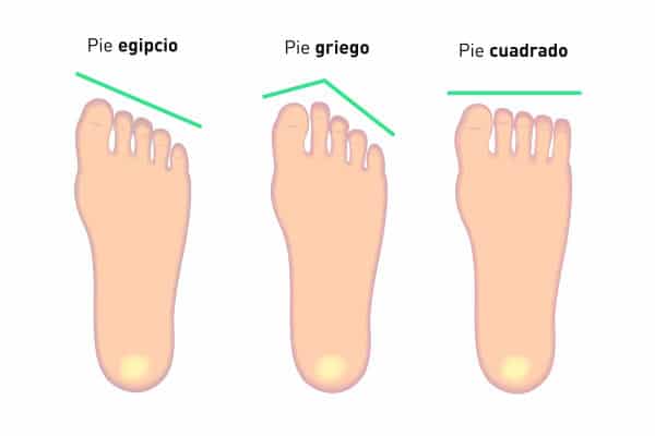Qué tipos de pie existen y qué características tienen
