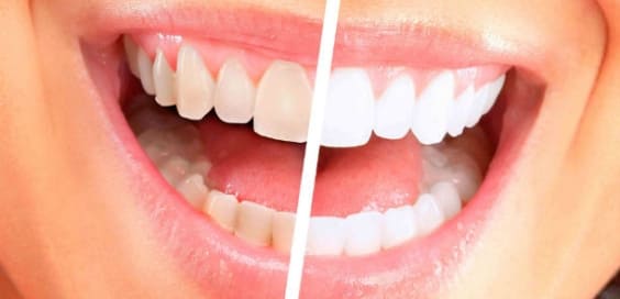 Sonrisa Perfecta - Unidad Estética Dental