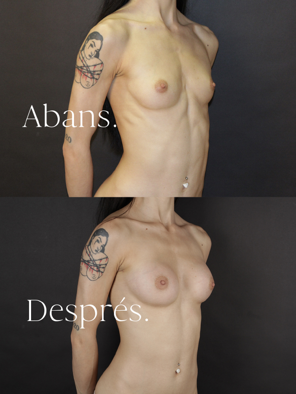 antes-y-despues