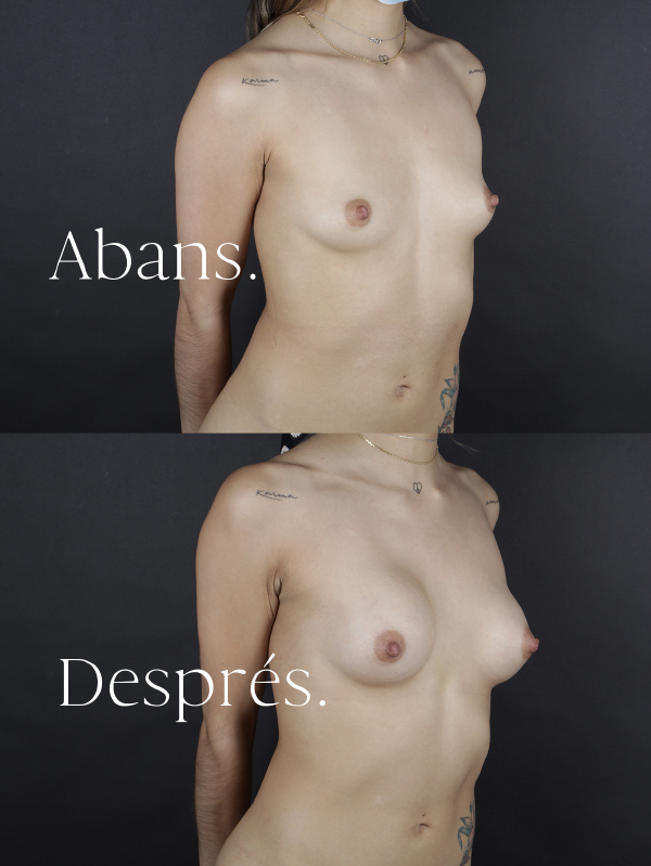 antes-y-despues