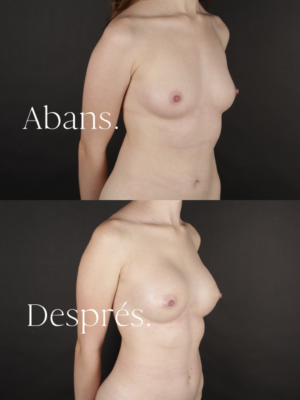 antes-y-despues