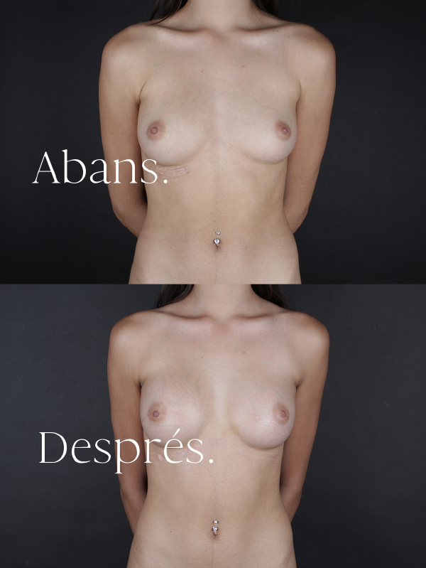 antes-y-despues