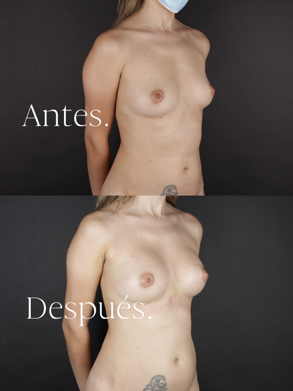 antes-y-despues