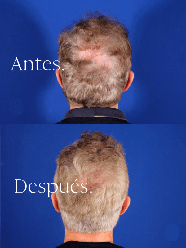 antes-y-despues