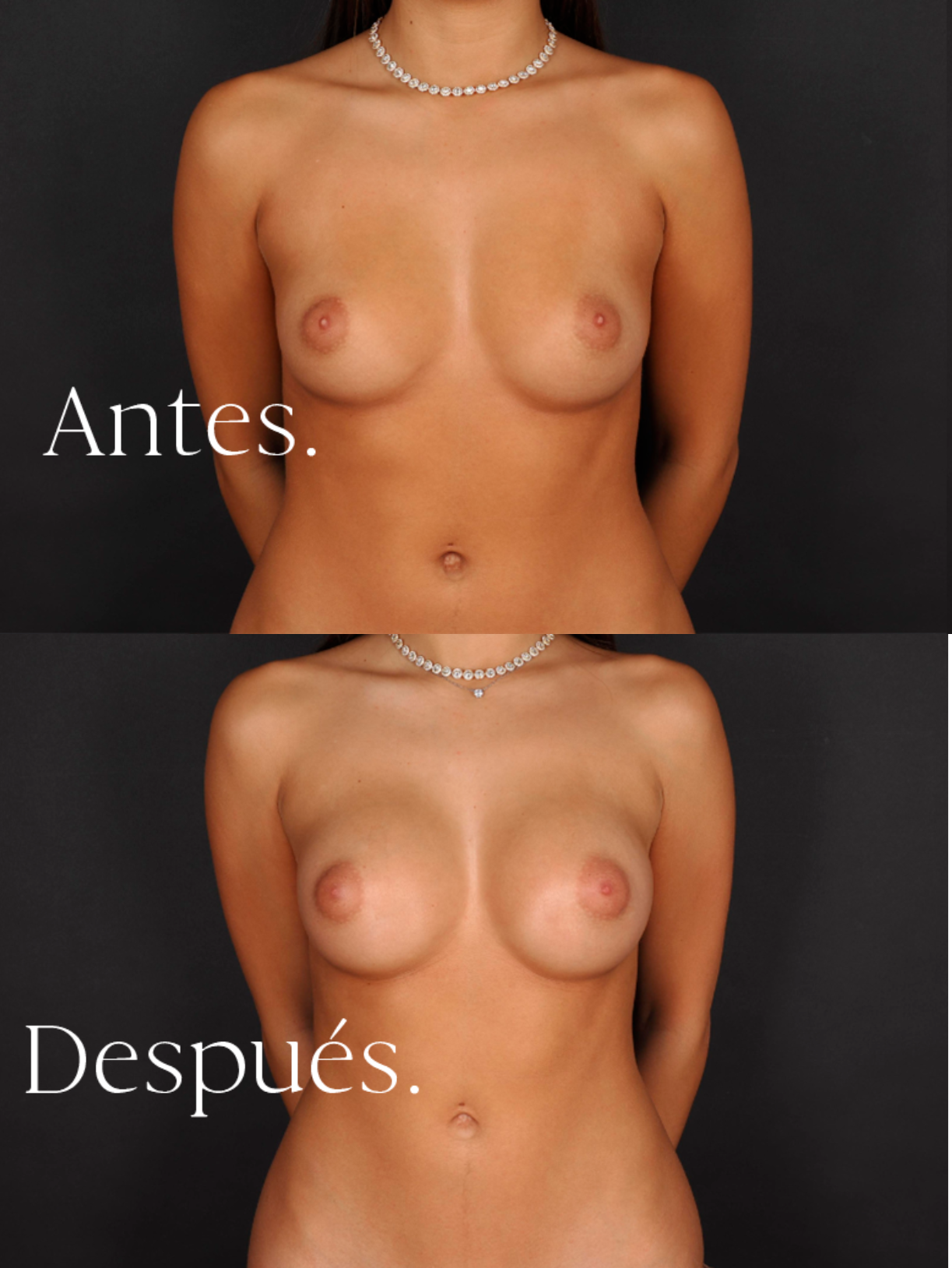 antes-y-despues