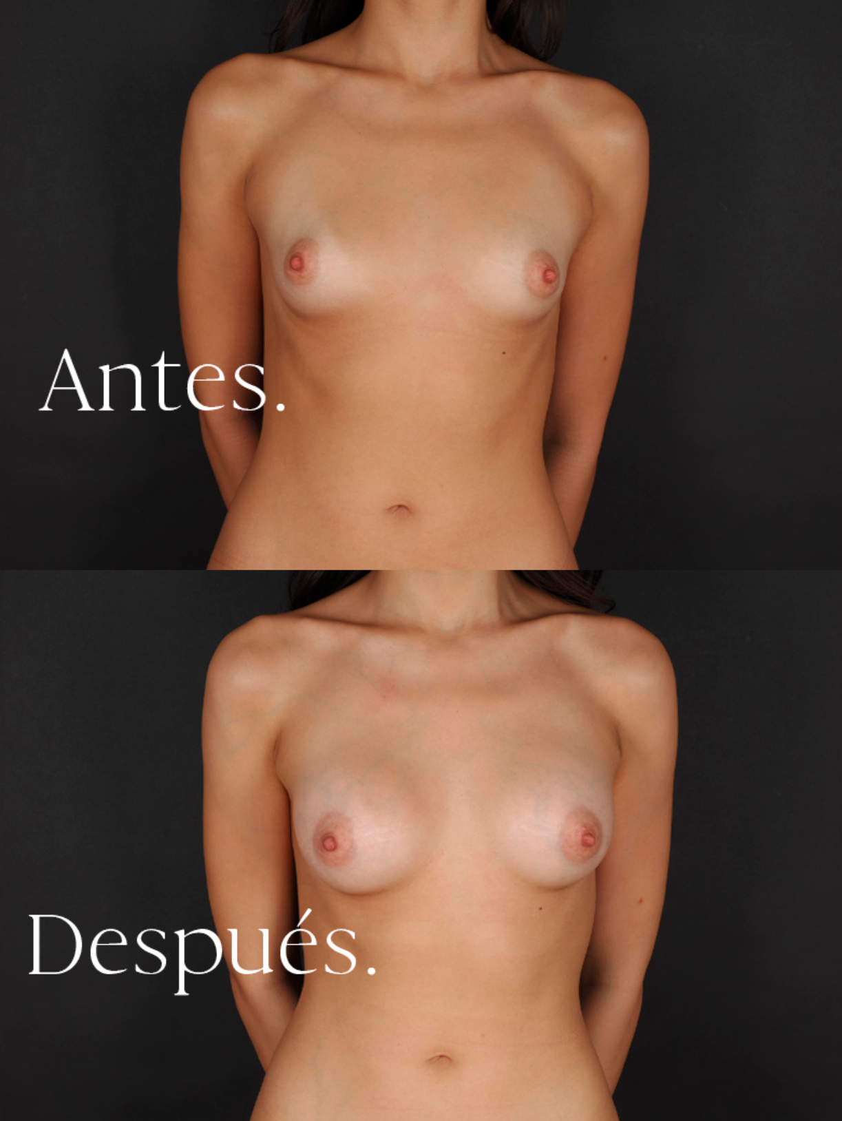 antes-y-despues