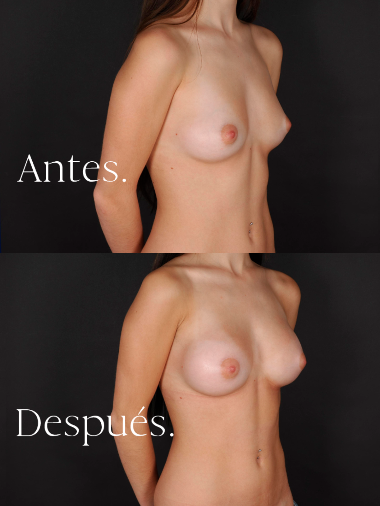 antes-y-despues