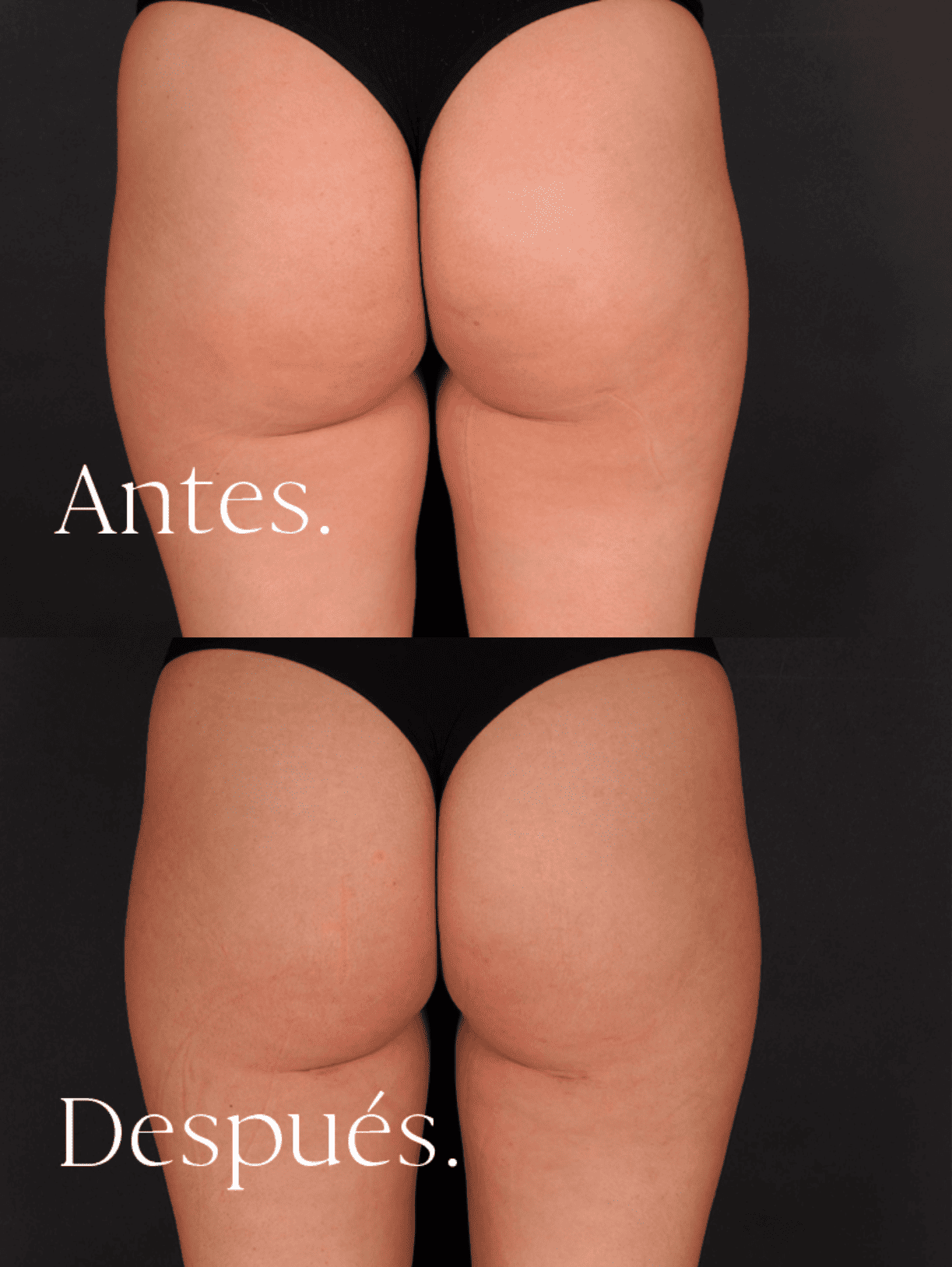 antes-y-despues