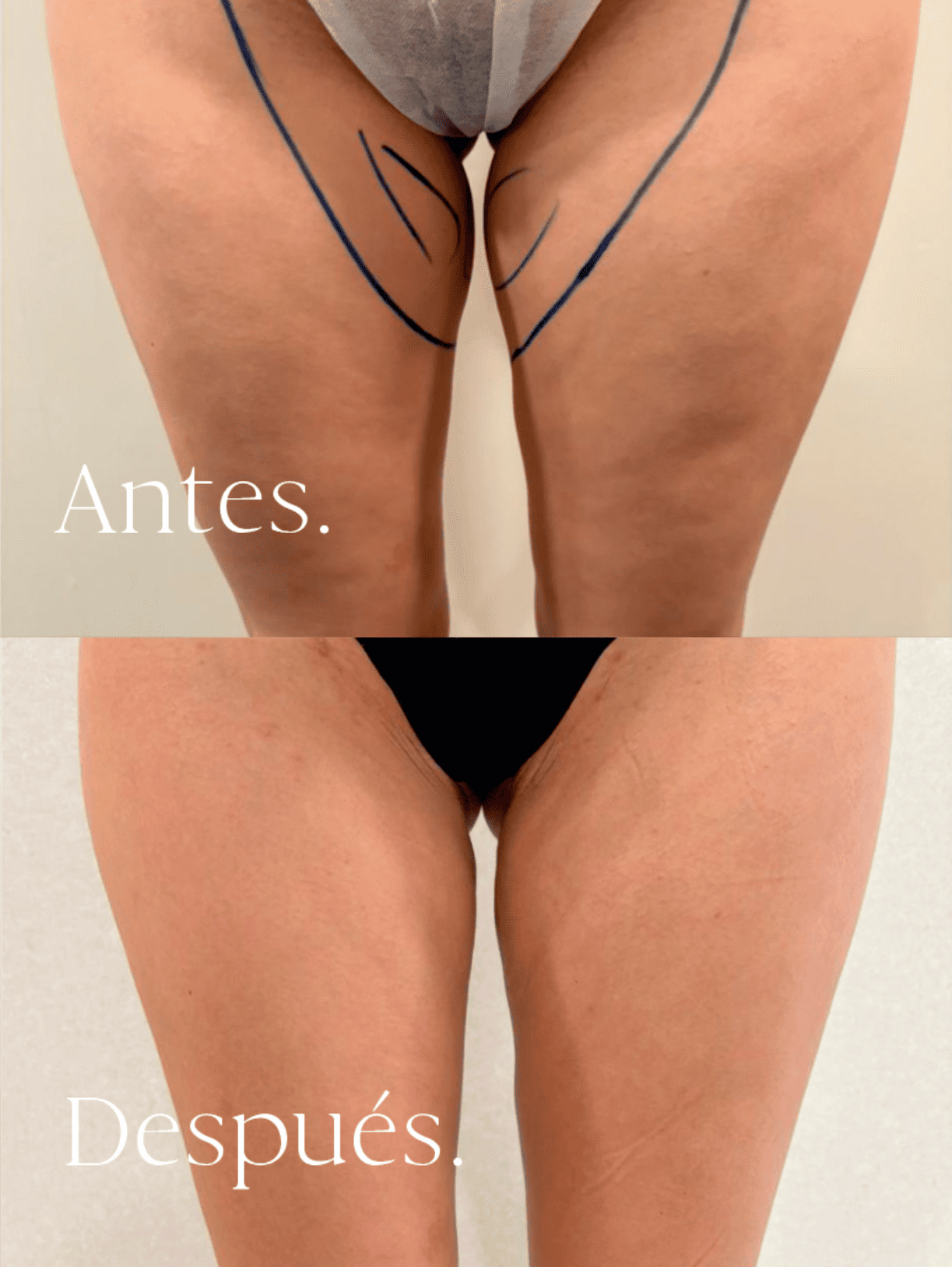 antes-y-despues