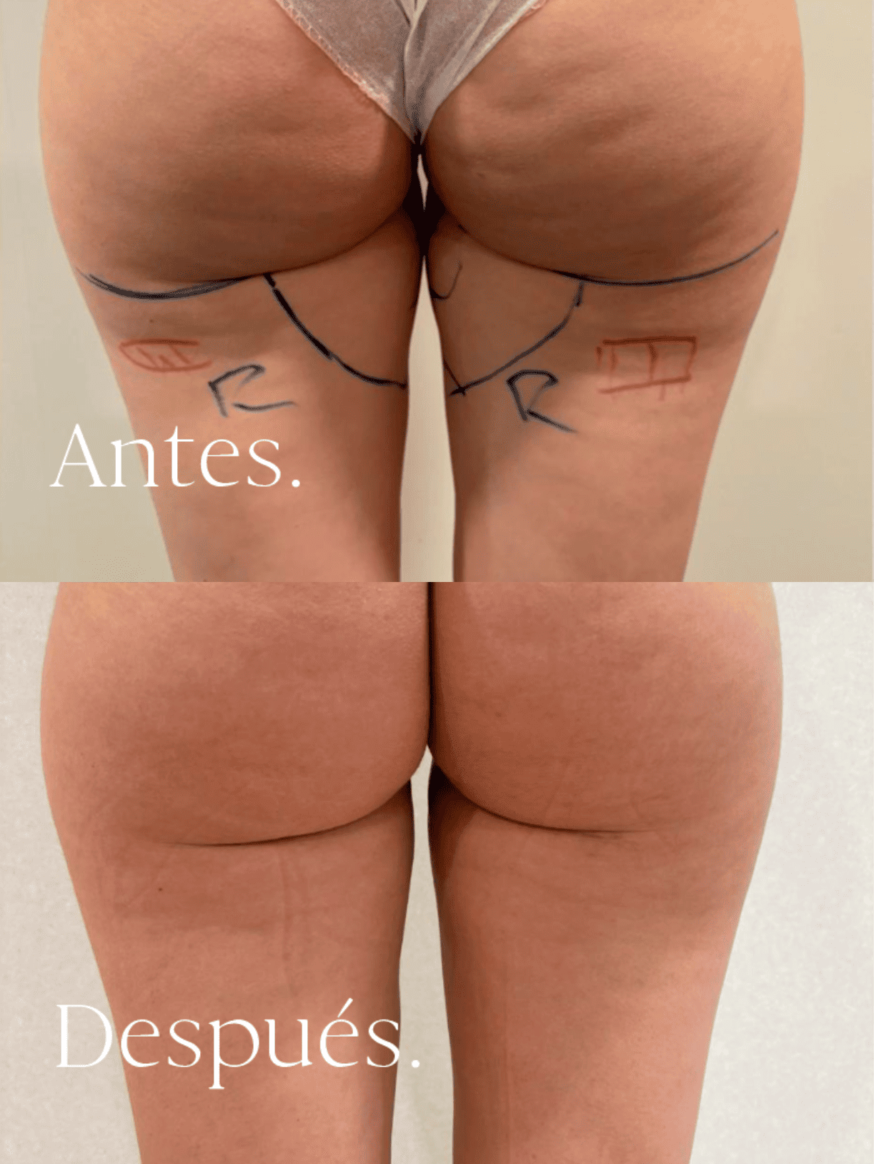antes-y-despues