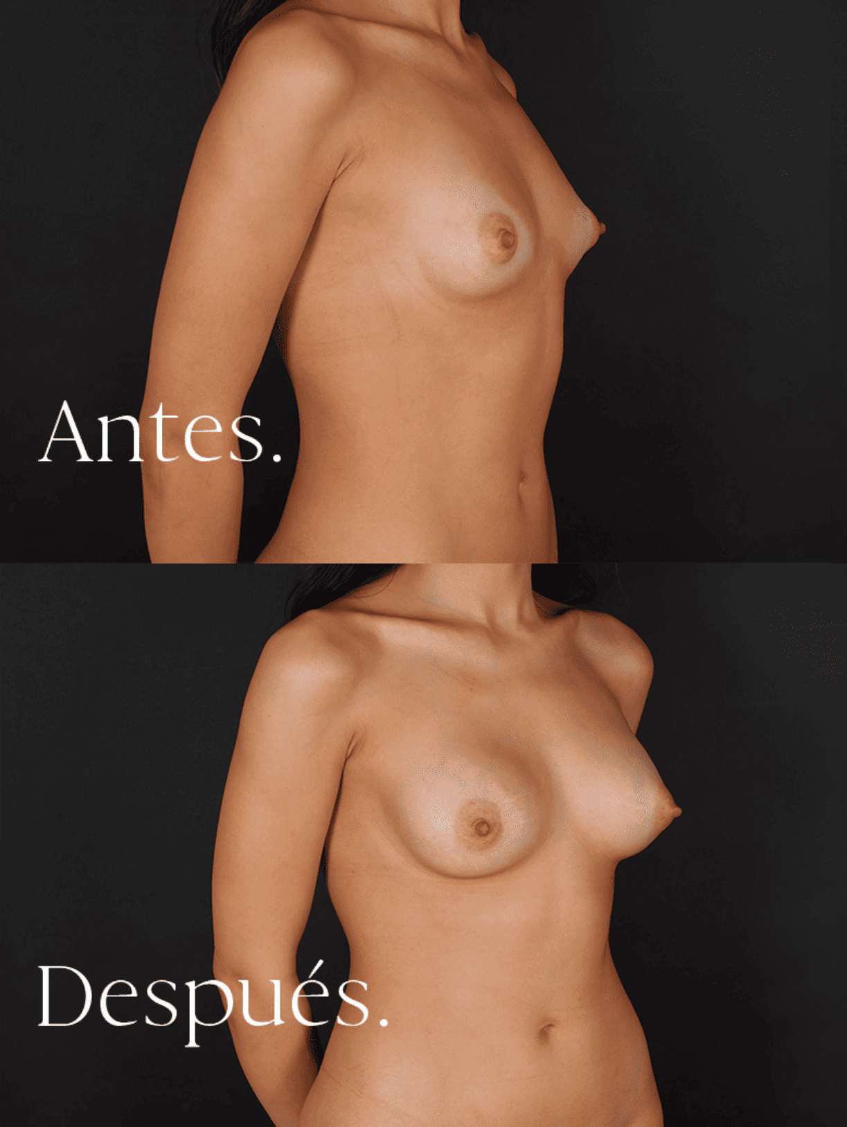 antes-y-despues