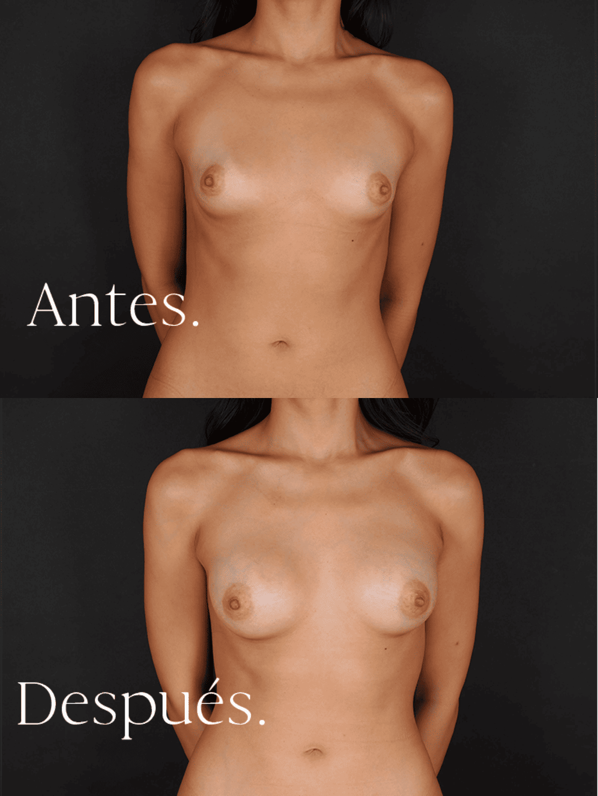 antes-y-despues