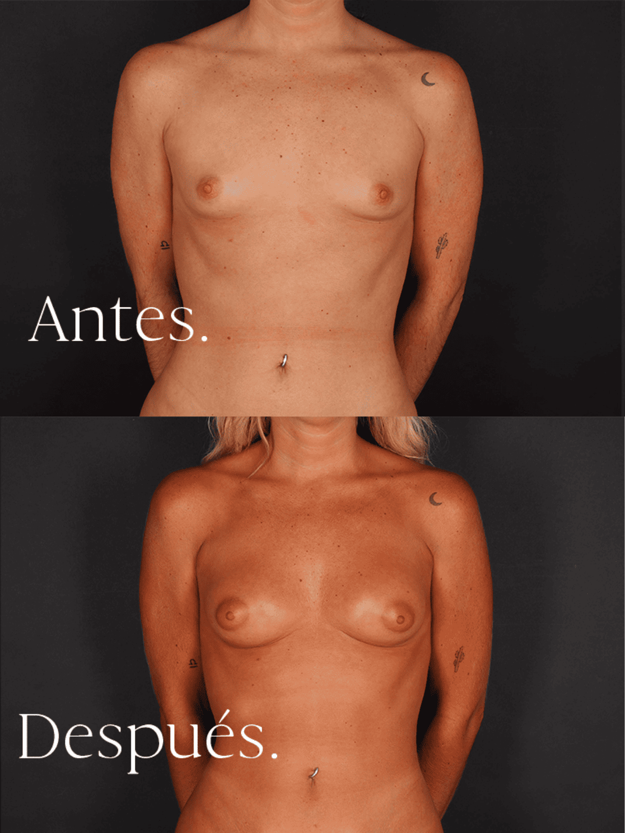 antes-y-despues