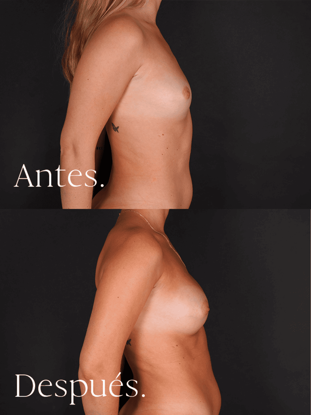 antes-y-despues