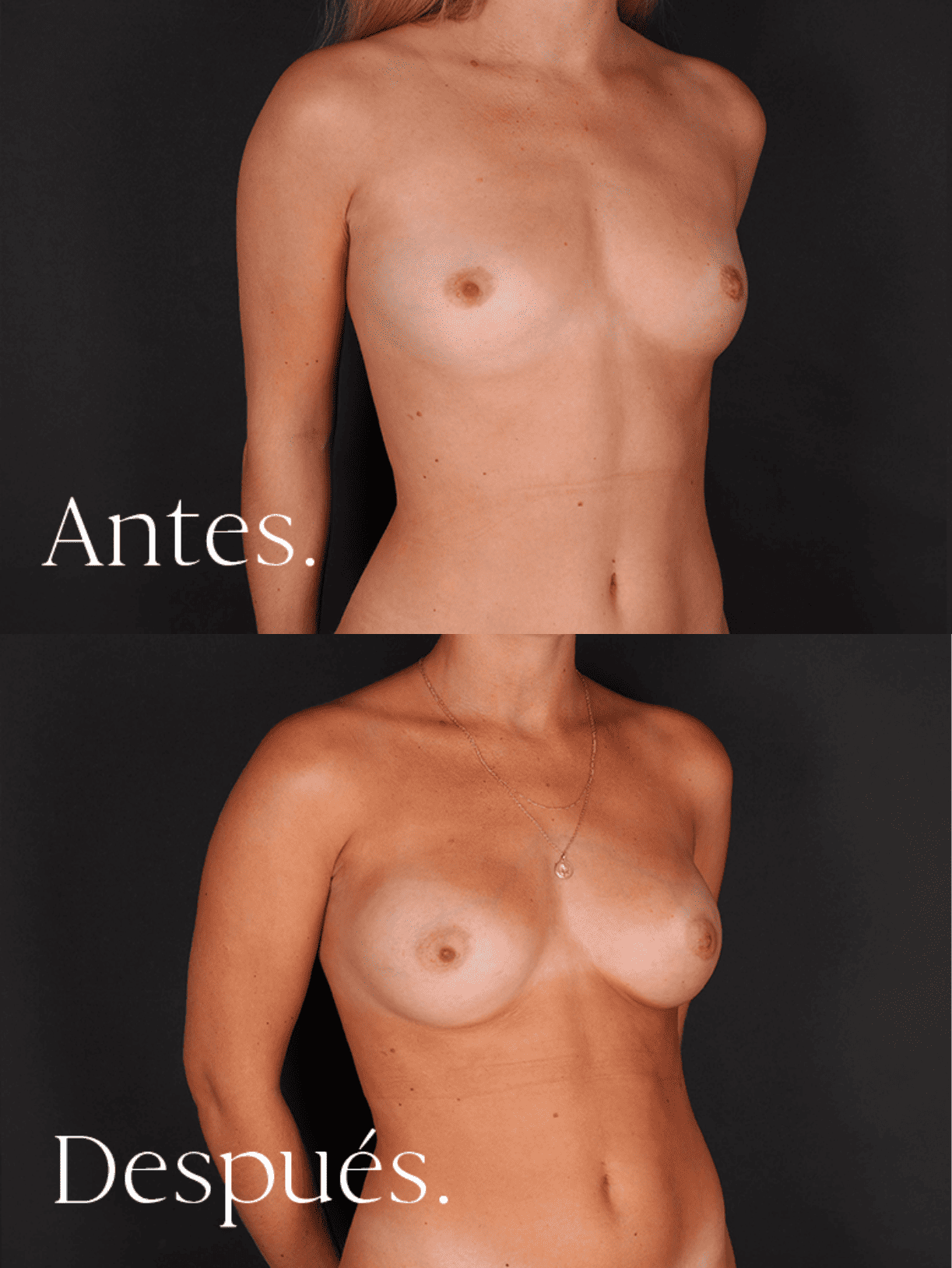 antes-y-despues