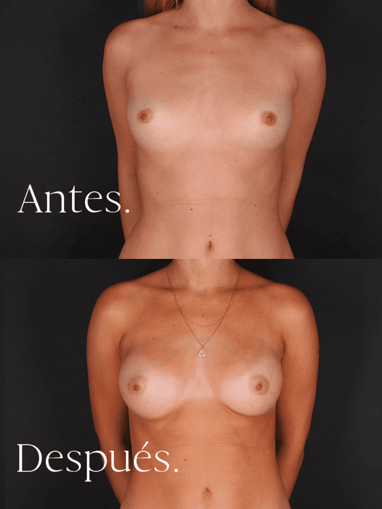 antes-y-despues