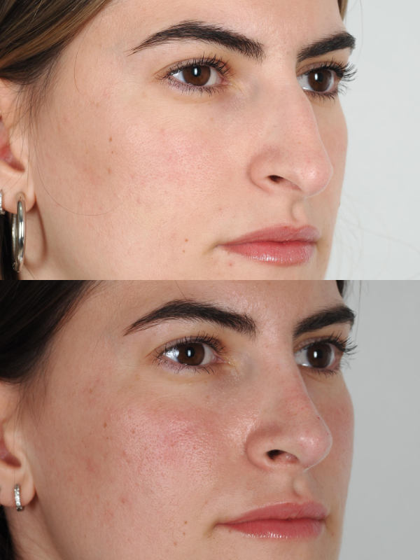 Nas antes y después